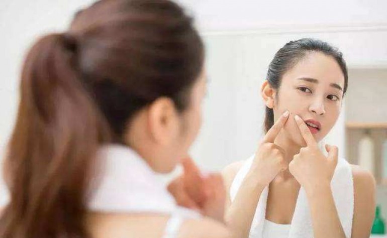 怎樣快速祛痘祛痘印？祛痘祛痘印最捷近的一條路 趕緊收藏 美容護膚獨生美官網
