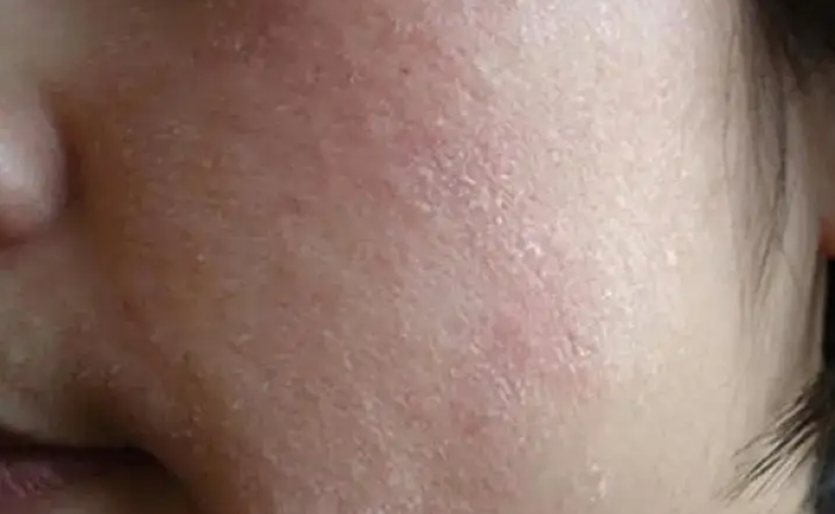 【獨生美】618好物就在視頻號 皮膚換季敏感拯救夏季干皮 懶人專用護膚品